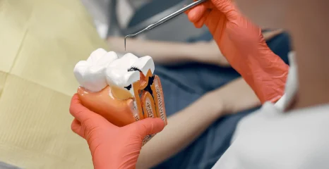 Root Canal Costs in Dubai: Is It Affordable? Choose the Best Dental Clinic and Medical Center in Dubai